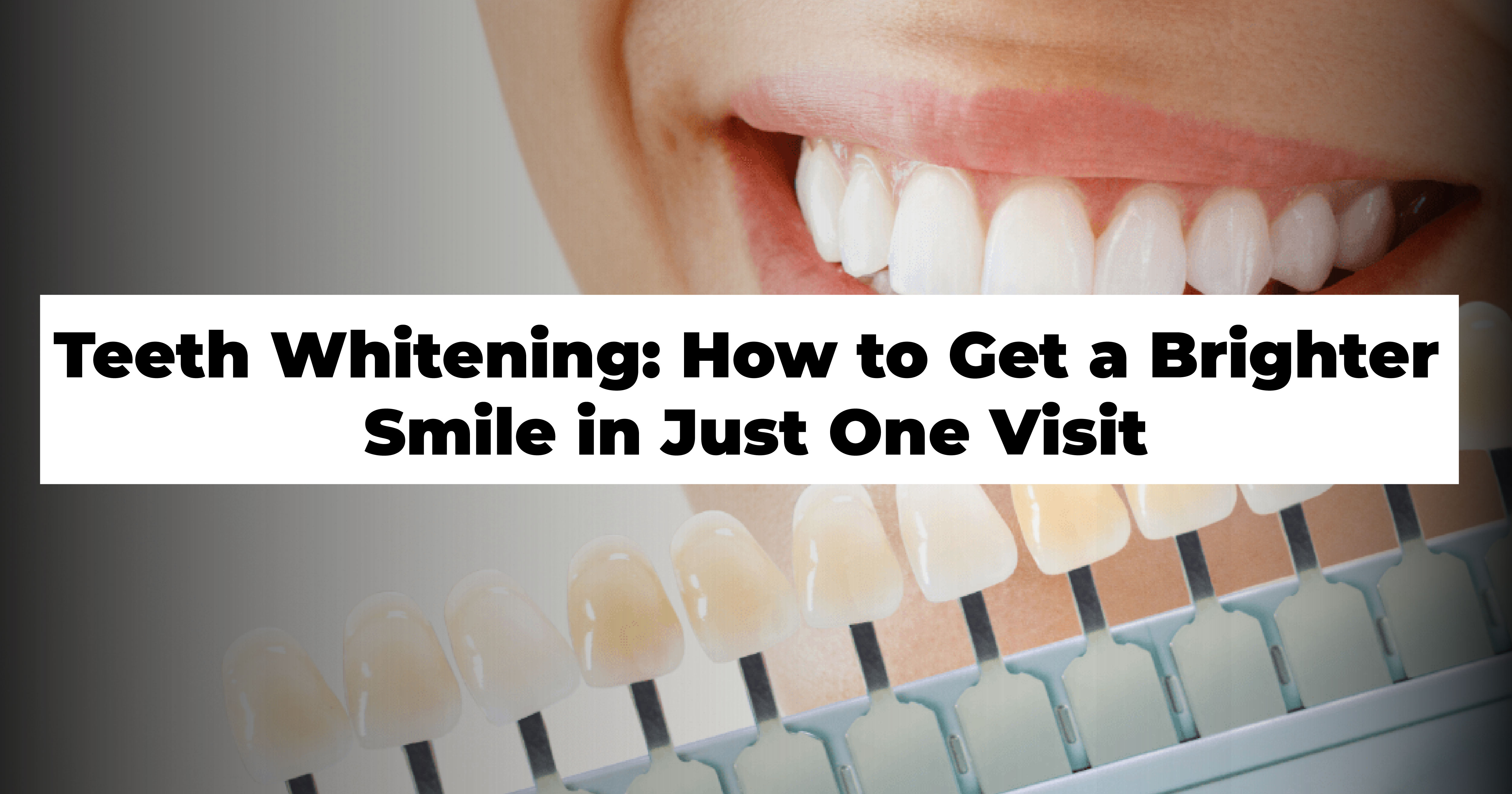 https://venunaddental.com.lttrbx.in/uploaded_file/files/img/news/Teeth Whitening